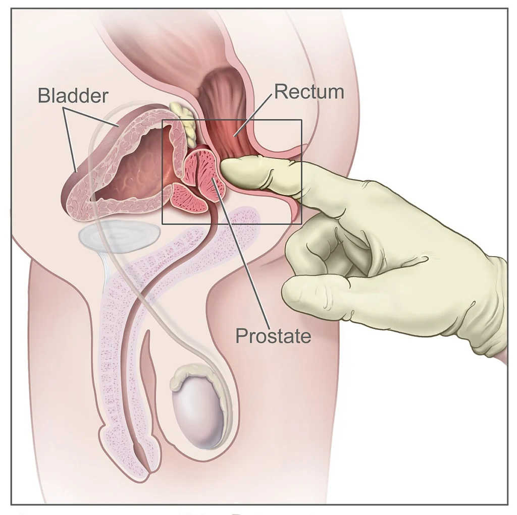 Male G-Spot